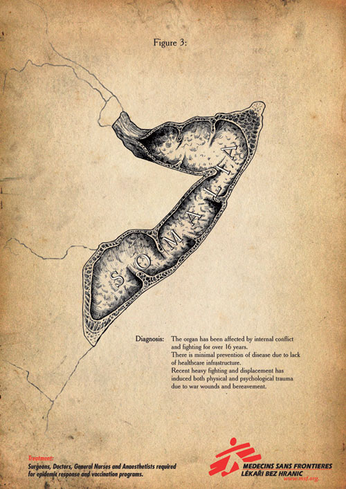 Печатная реклама "Human Organs 3", рекламодатель: Medicines Sans Frontiers recruitment, агентство: McCann Erickson Prague